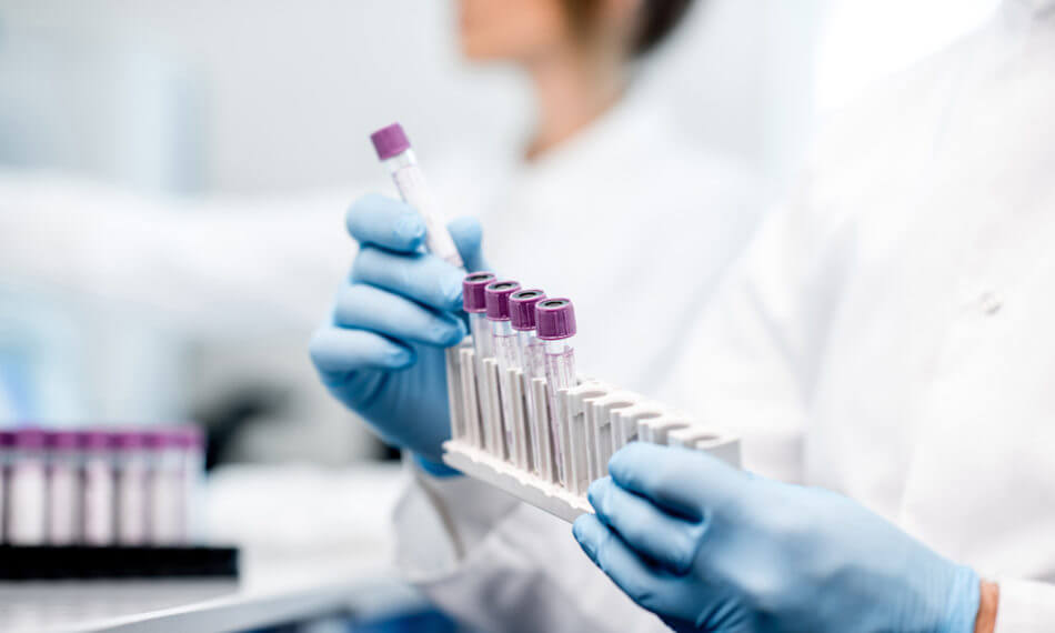 A pharmacist handling a row of test tubes with gloves on